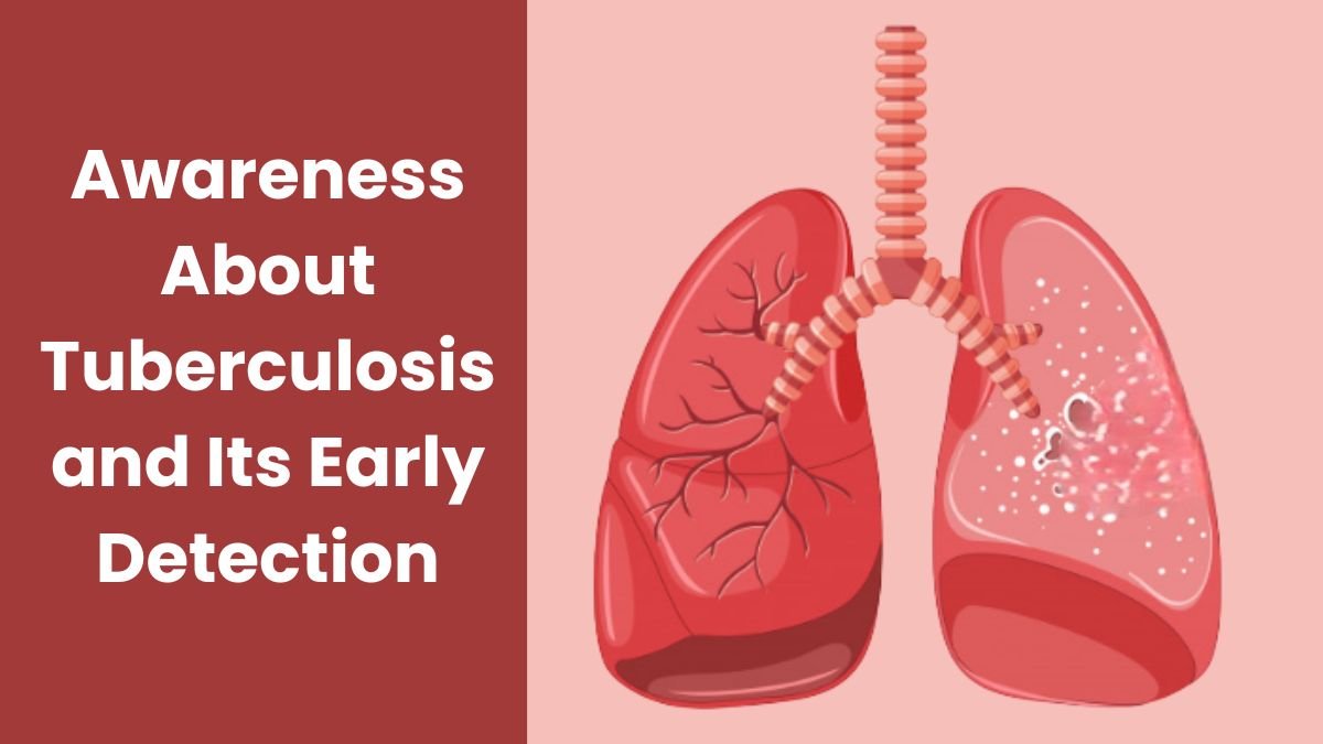 Awareness About Tuberculosis and Its Early Detection